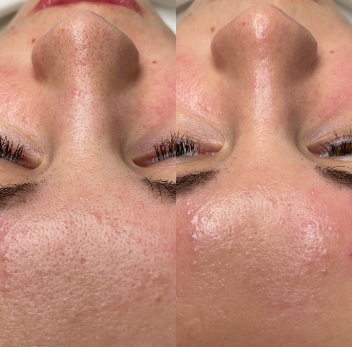 Результат 1