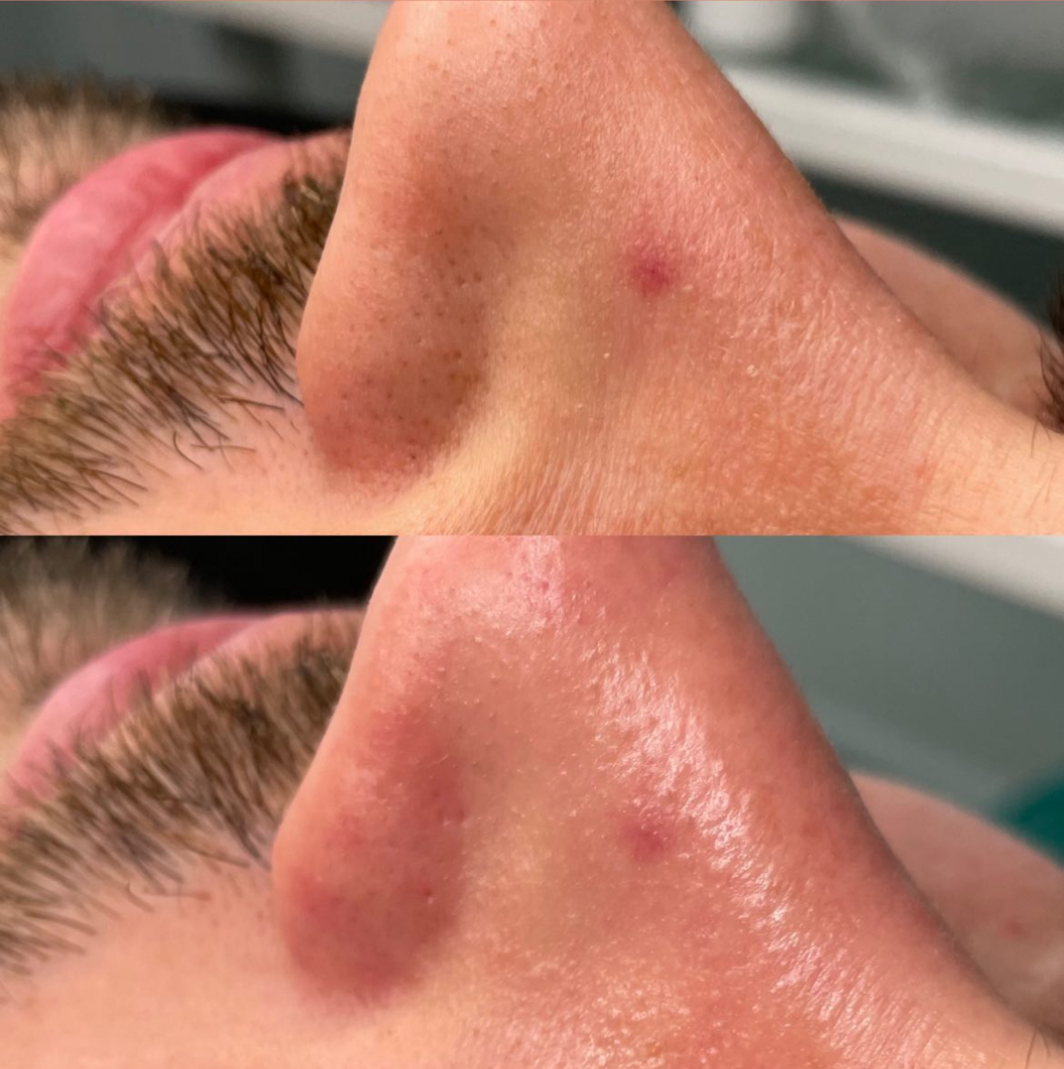 Результат 5