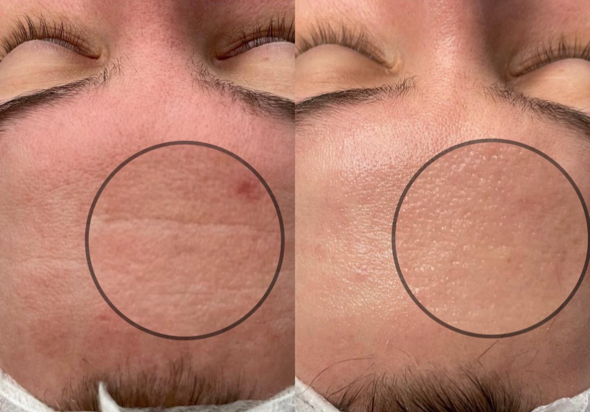 Результат 6