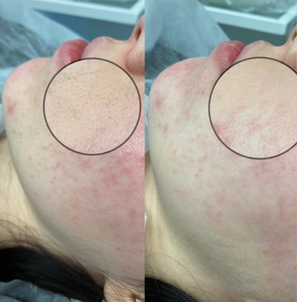 Результат 7