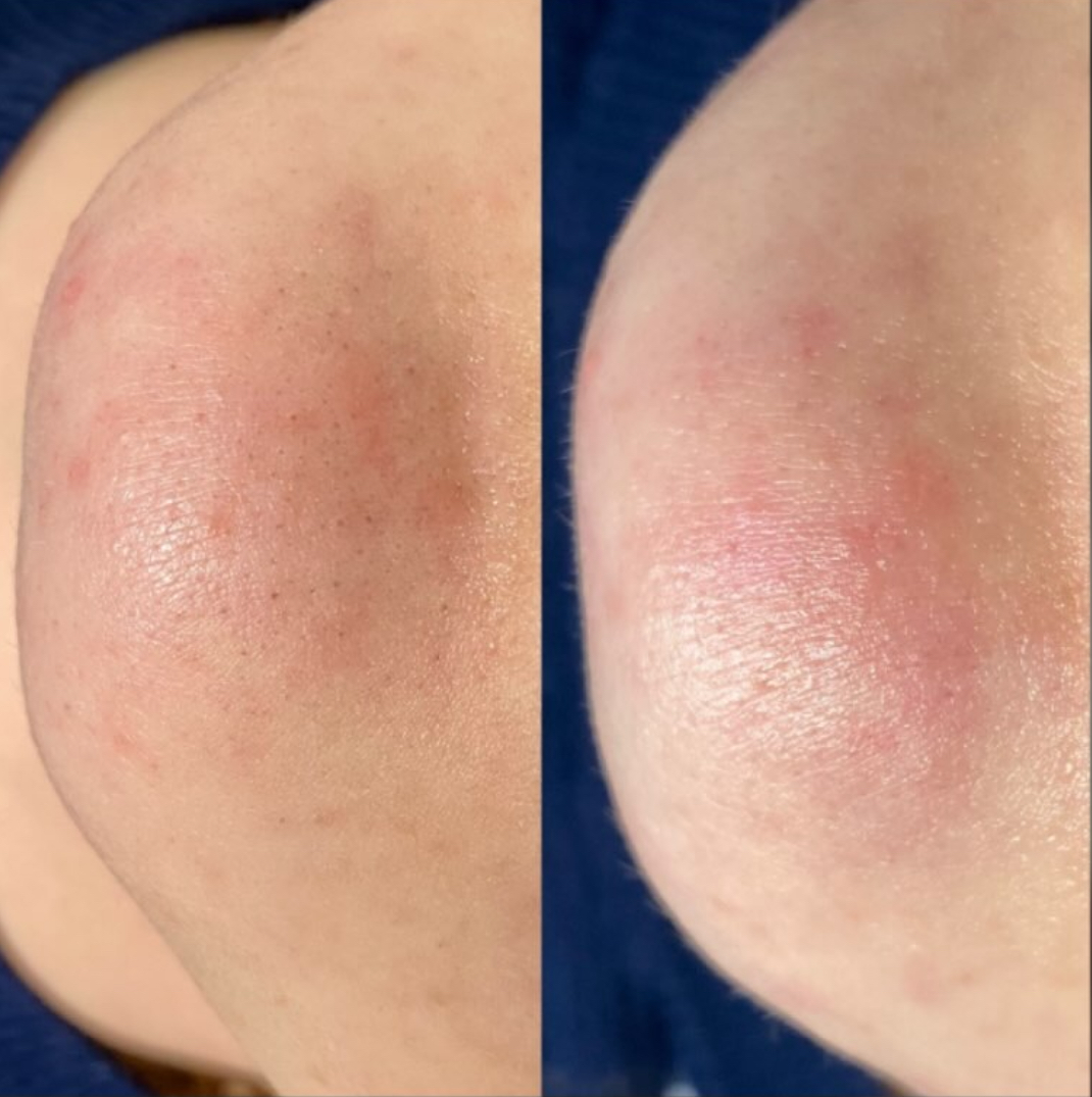 Результат 8