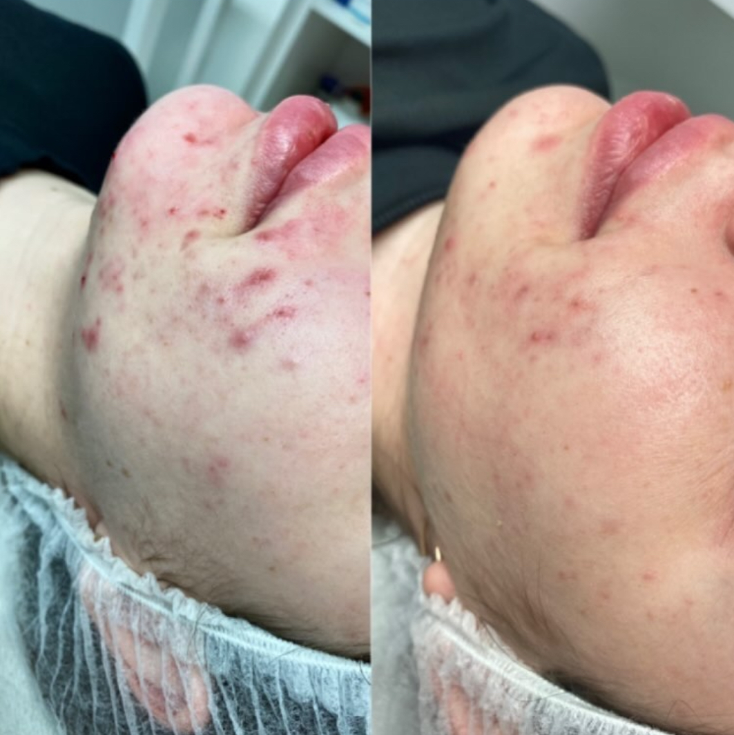 Результат 9